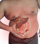 תרופה לטיפול בכבד שומני:  פריצת דרך רפואית-תמונה